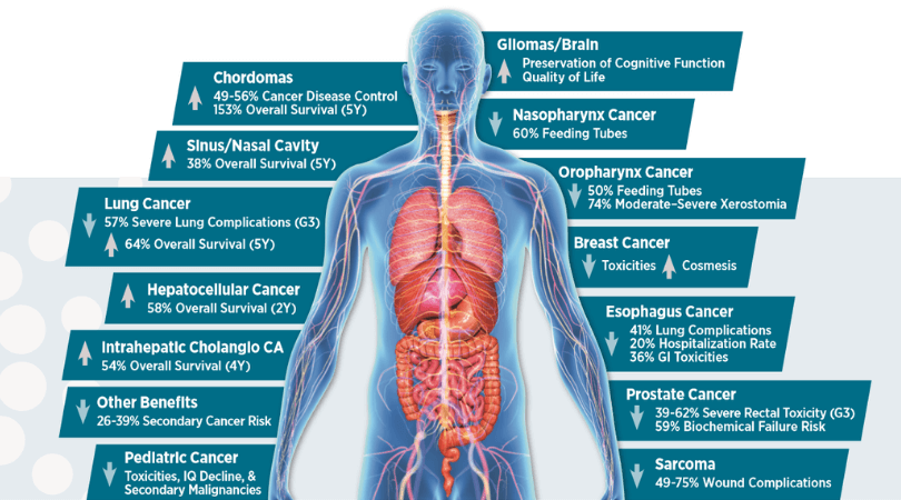 Cancers Treated - Maryland Proton Treatment Center